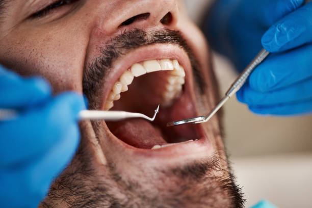 Best Weekend Emergency Dentist in Martinsburg, PA